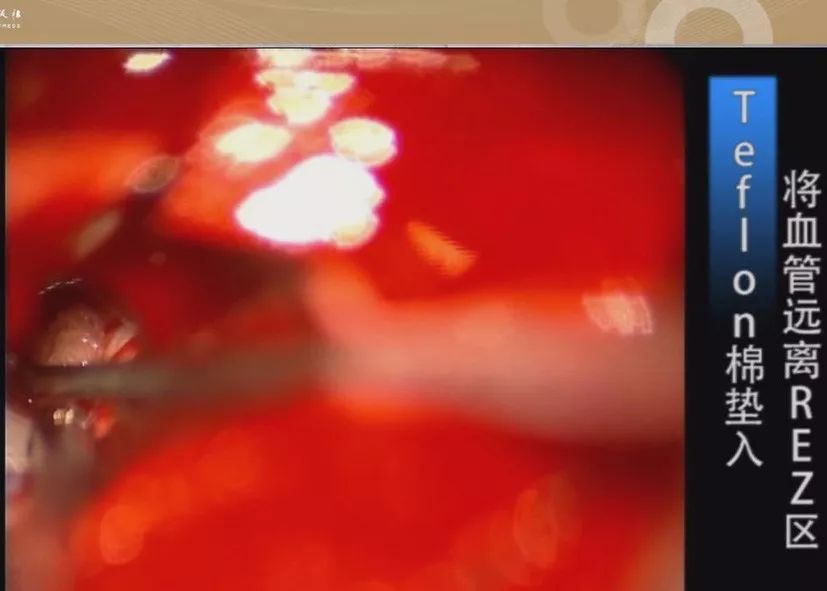 汉中星璨火吧餐饮有限公司 招标海报