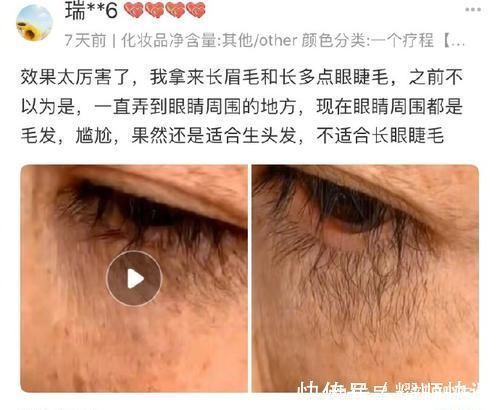 97精品伊人久久久大香线蕉 不仅肤质得到明显改善海报