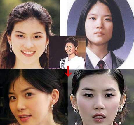 火影忍者野原琳 这是火影p站结构性的悲剧海报